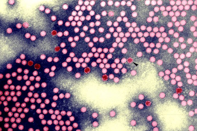 Polio Recently Turned Up Again—Here’s How a Leading Infectious Disease Doctor Says You Can Help Prevent It