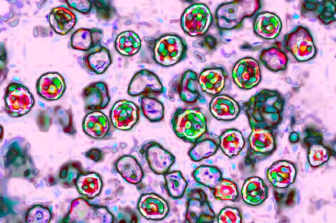 Measles Cases Have Just Been Confirmed in 4 More States